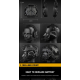 Taktický headset Gen 5 + montáž helmu FAST, černý